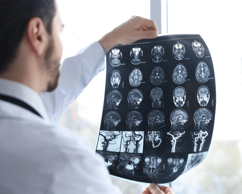 Doctor holding and reviewing a brain scan with multiple imaging panels, illustrating the diagnosis and evaluation of traumatic brain injuries in Oklahoma City accident cases.